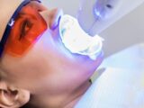 Diş Beyazlatmada Kullanılan En Yeni Teknikler