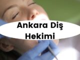 Ankara en iyi diş hekimi tavsiye listesini inceleyin.